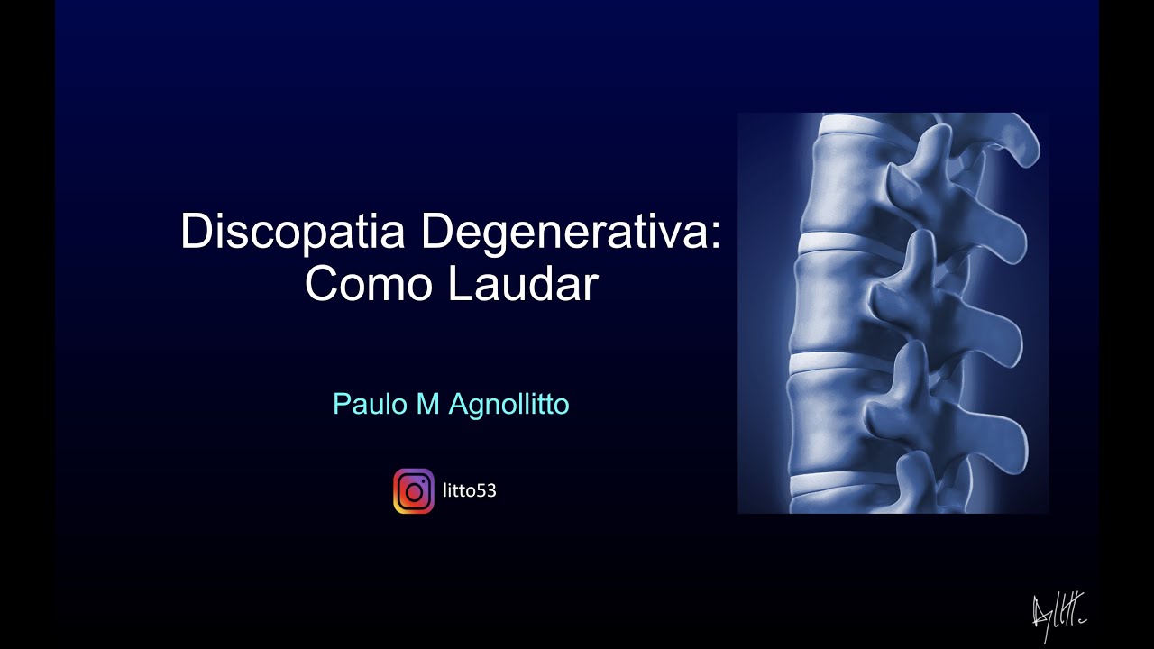 DISCOPATIA DEGENERATIVA: COMO LAUDAR?