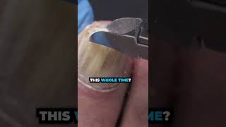 A SOLUTION for THICK NAILS?