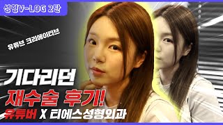 15만 유튜버 눈재수술 브이로그 2탄❗ l  티에스성형외과