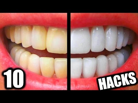 Teeth Whitening Tips: How to Remove Teeth Stains Video