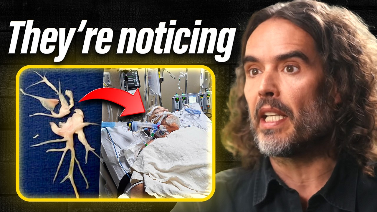 This Explains Everything