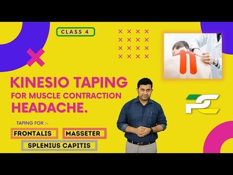 5 BEST NERVOUS SYSTEM MOBILIZATION EXERCISES TO TREAT HEADACHE PATIENTS