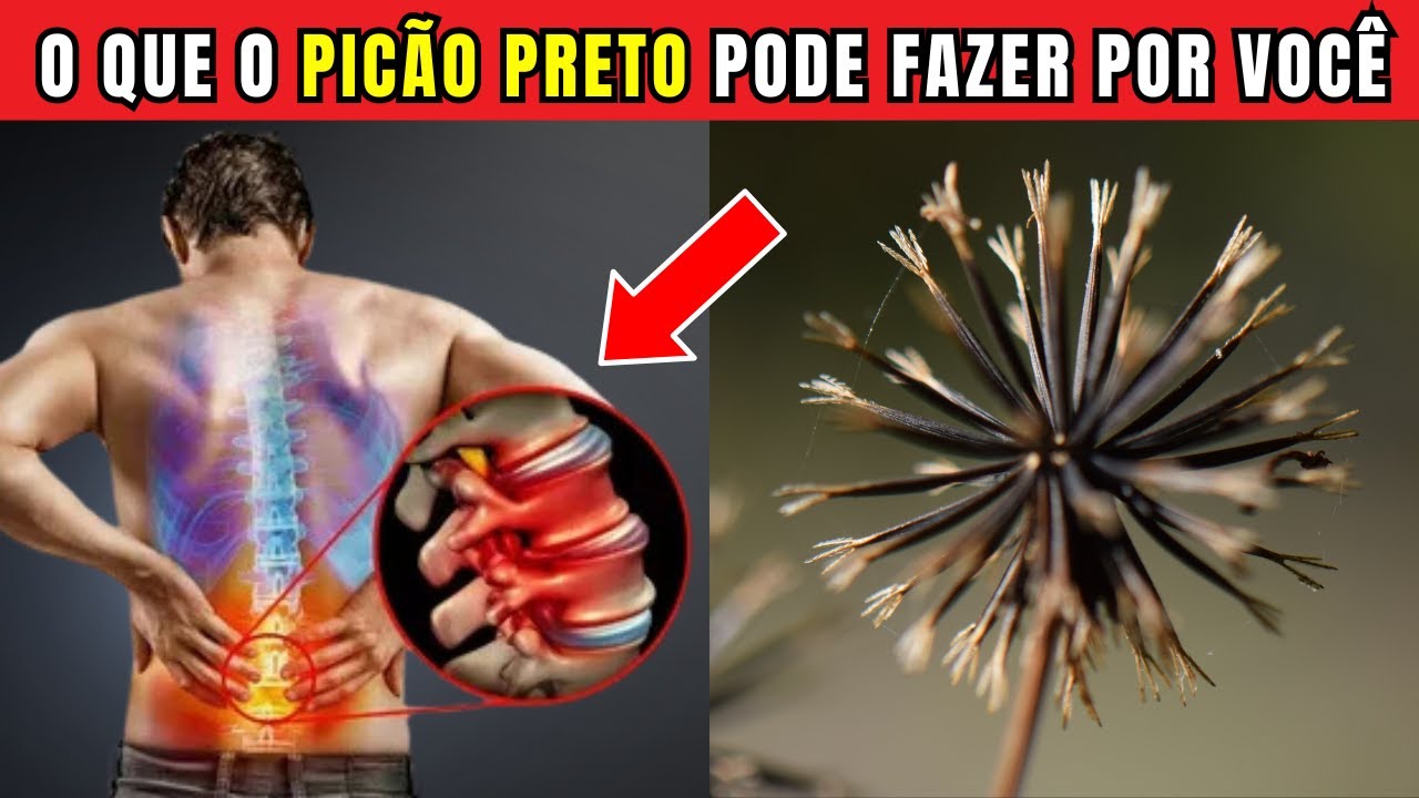 O Anti-Inflamatório Natural que Você Precisa Conhecer: Picão Preto