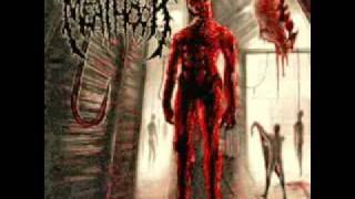 Meathook - Worm Infested