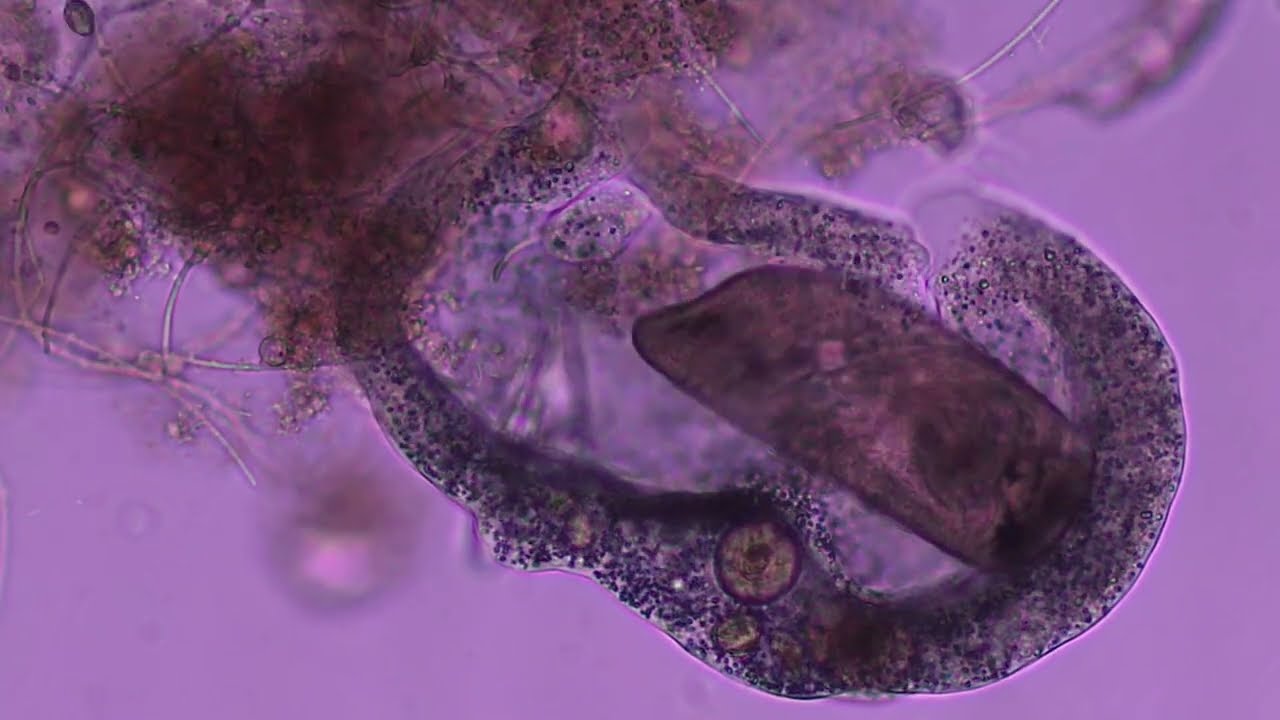 Amoeba in action 2026