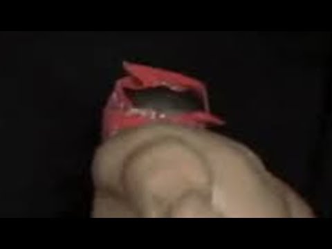 HOW TO DODGE CASSIOPEA'S ULT