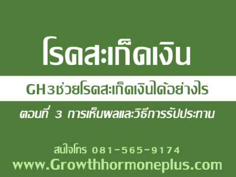 กลากแสงอาทิตย์ ทั้งหมด neurodermatitis ในผู้ใหญ่
