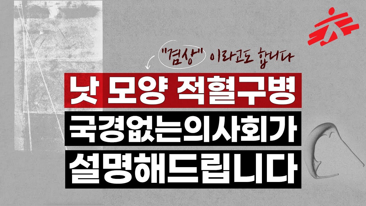 낫 모양 적혈구병 국경없는의사회가 설명합니다