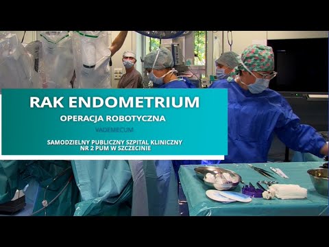 Rak endometrium - vademecum