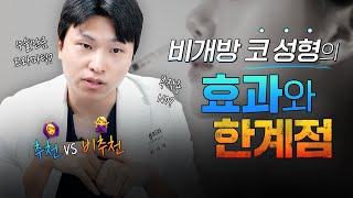 코 수술에 너무 부담스럽다?! 코젤코 제대로 알기!