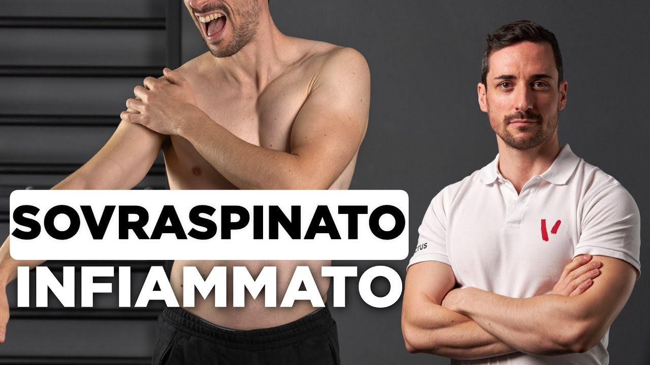 Watch Now Lesione o infiammazione del sovraspinato: cosa fare Lesione o infiammazione del sovraspinato: cosa fare