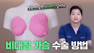짝가슴을 해결하는 이준욱 원장만의 시그니처 수술법
