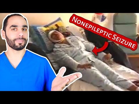 How to Diagnose Nonepileptic Seizures (PNES)