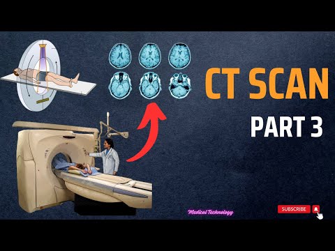 What is a C Arm Machine and How to work Working principle of C Arm Uses