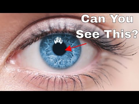 Have Your Mind Blown By This Explanation About How To See Inside Your Own Eyeball