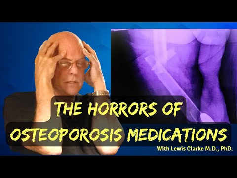 What They Aren't Telling You About Osteoporosis Medication