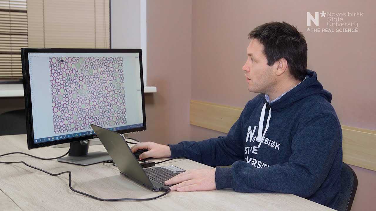 Сервис анализа изображений Nanoparticles