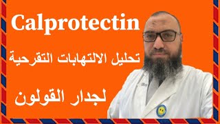 تحليل الالتهابات التقرحية للقولون #calprotectin