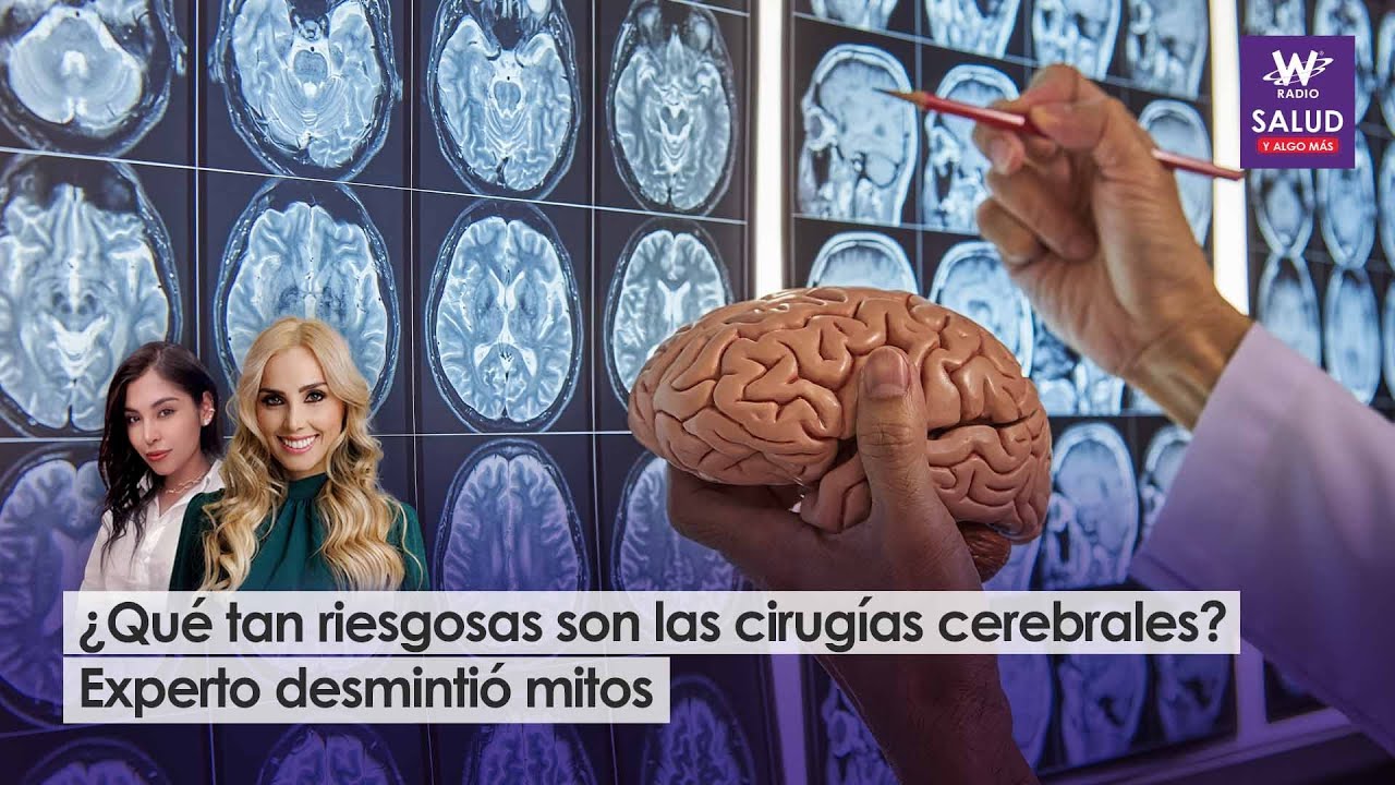 ¿Qué tan riesgosas son las cirugías cerebrales? Experto desmintió mitos | Salud y Algo Más