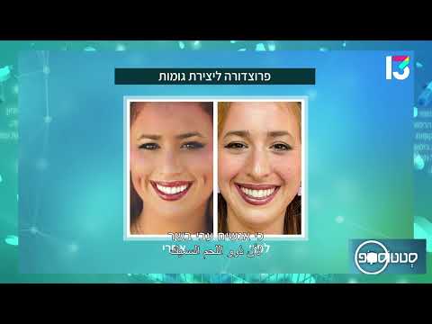 זמן למהפך: הליך ליצירת גומות חן