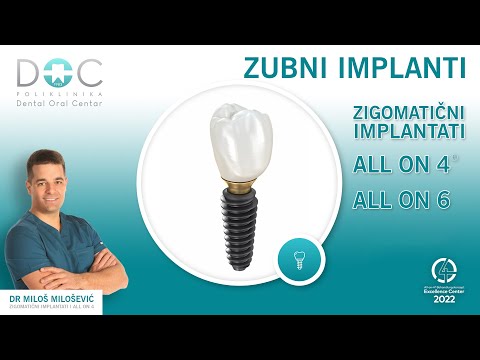 Zubni Implanti - trajna opcija nadoknade izgubljenih zuba - Dental Oral Centar