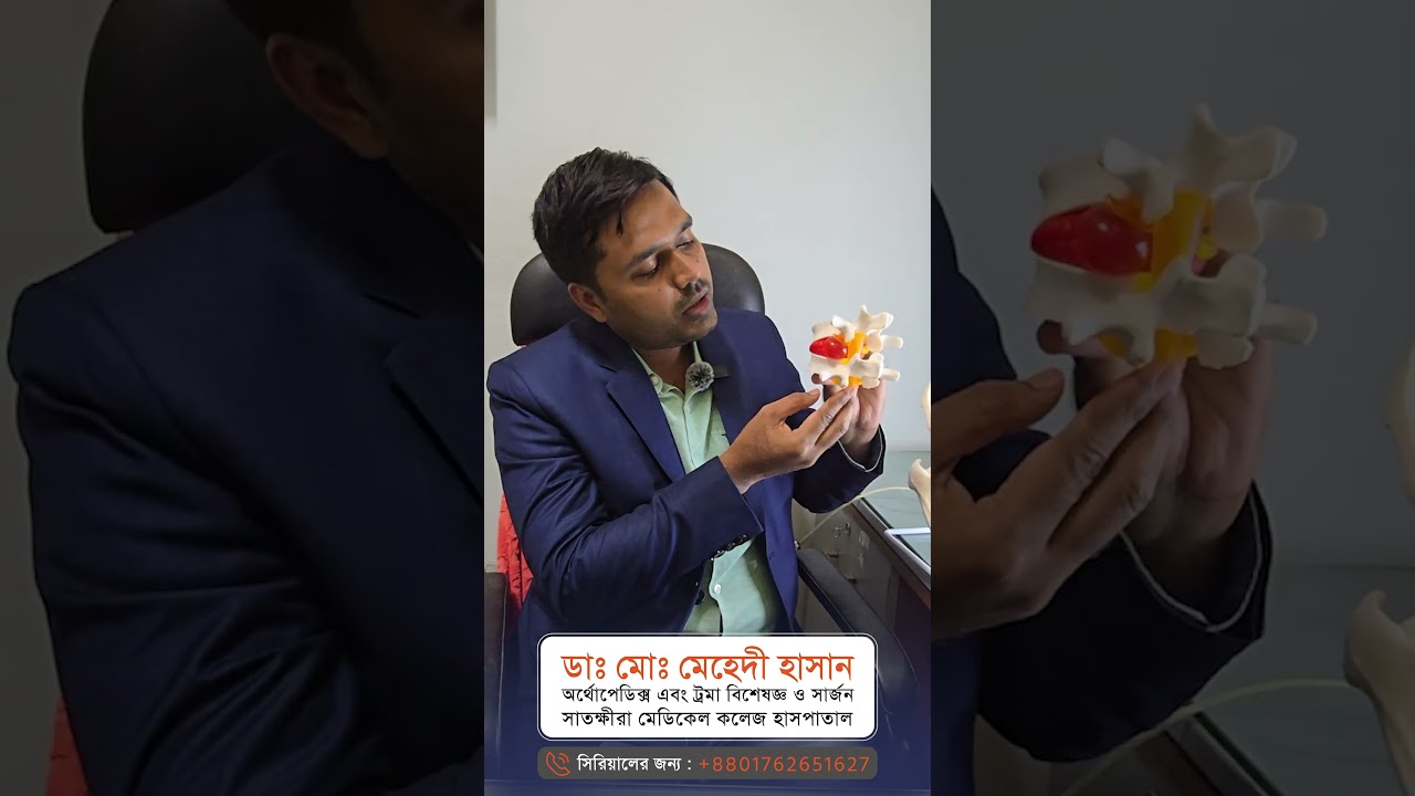 PLID কোমর ব্যথার কারণ