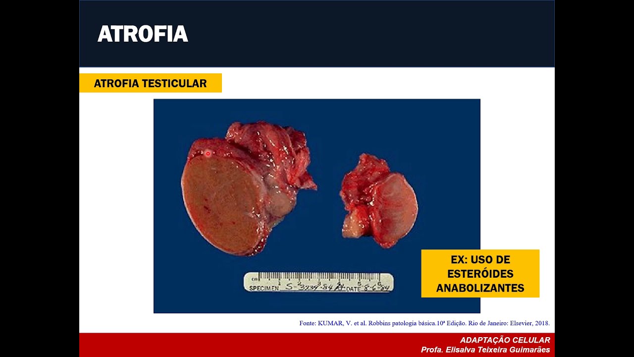 Aula 02 - Adaptações Celulares (Parte II)