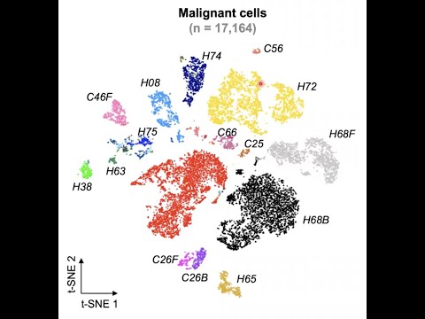 Understanding of Tumor Heterogeneity and Tumor Evolution in Liver Cancer
