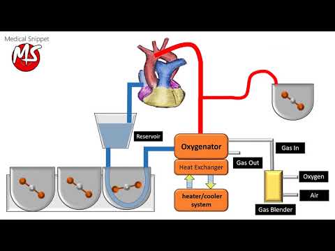 Cardiopulmonary bypass (CPB) circuit