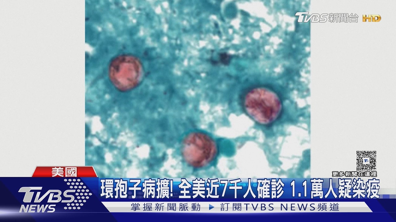 影音／環孢子蟲病疫情釀2死！全美近7千人確診　1.1萬人疑染疫