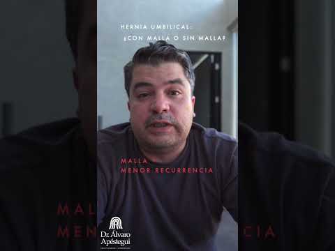 Hernia umbilical: ¿con malla o sin malla?