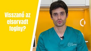 Visszanő az íny? A fogorvos válaszol
