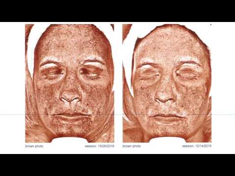 download lagu mp3 mp4 Esthetician Biography Samples, download lagu Esthetician Biography Samples gratis, unduh video klip Esthetician Biography Samples