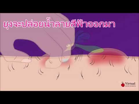 การเยียวยาความอ่อนแอพื้นบ้าน ความคิดเห็นของ Exciter ม้าสำหรับผู้หญิง