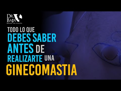 Renato Rodríguez Hirales-52