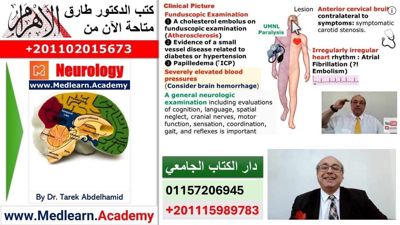 Neurology - Stroke (I) B
