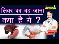 लिवर का बढ़ जाना क्या है ये WHAT IS HEPATOMEGALY