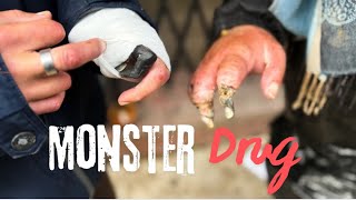 This Drug Is Eating People’s Skin  Kensington Exposed | Linwood 