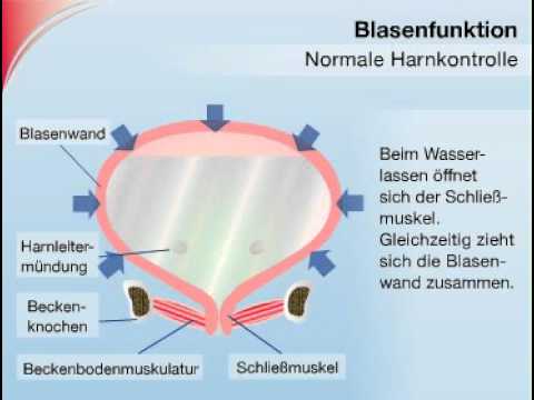 Prostatakrebs-Programm Vitaprost forte Tabletten Bewertungen