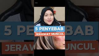 Download lagu Jerawat nggak selalu karena produk, bisa dari kebiasaan.#jerawat  #tipskulit #kulitkusam  #fyp mp3