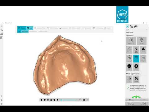 Tutorial (en): New features of the BDCreator® PLUS | #BalticDentureSystem