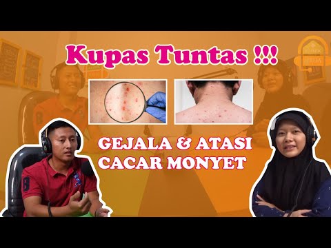 [WASPADA CACAR MONYET !!] Kenali Gejala dan Cara Penularannya.