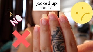 HOW TO: fix nails AFTER acrylics