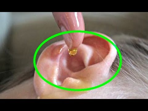 Amazing Natural Remedies for Ear Infection Home Remedies for Ear Infections Top 6 Home Remedies