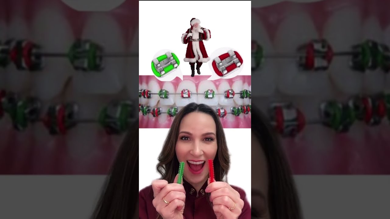 Watch Now Melhores cores de borrachinha para usar no aparelho fixo Melhores cores de borrachinha para usar no aparelho fixo