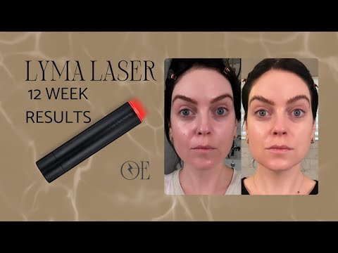 LYMA-Ergebnisse nach 12 Wochen