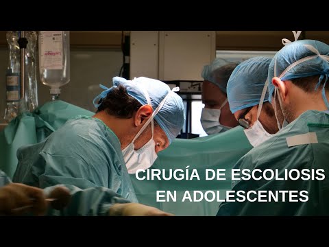 Cirugía de Escoliosis en adolescentes