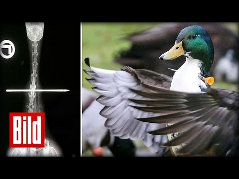Wie Rückenschmerzen bei einem Kind zu behandeln Schmerzen beim Wasserlassen Schmerzen im Rücken links