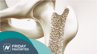 Friday Favorites: Bone Density, Fracture Rates, and Vitamin D in Vegans