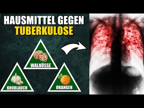 , title : '10 Natürliche Hausmittel gegen Tuberkulose'